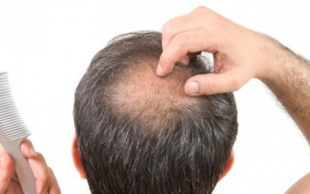 Premier Stem Cell Hair Loss Package