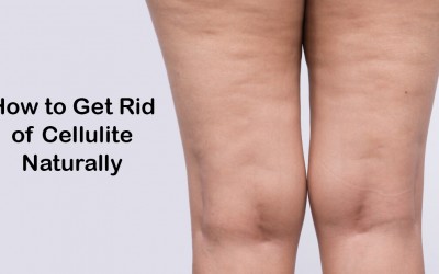 How to Get Rid of Cellulite Naturally
